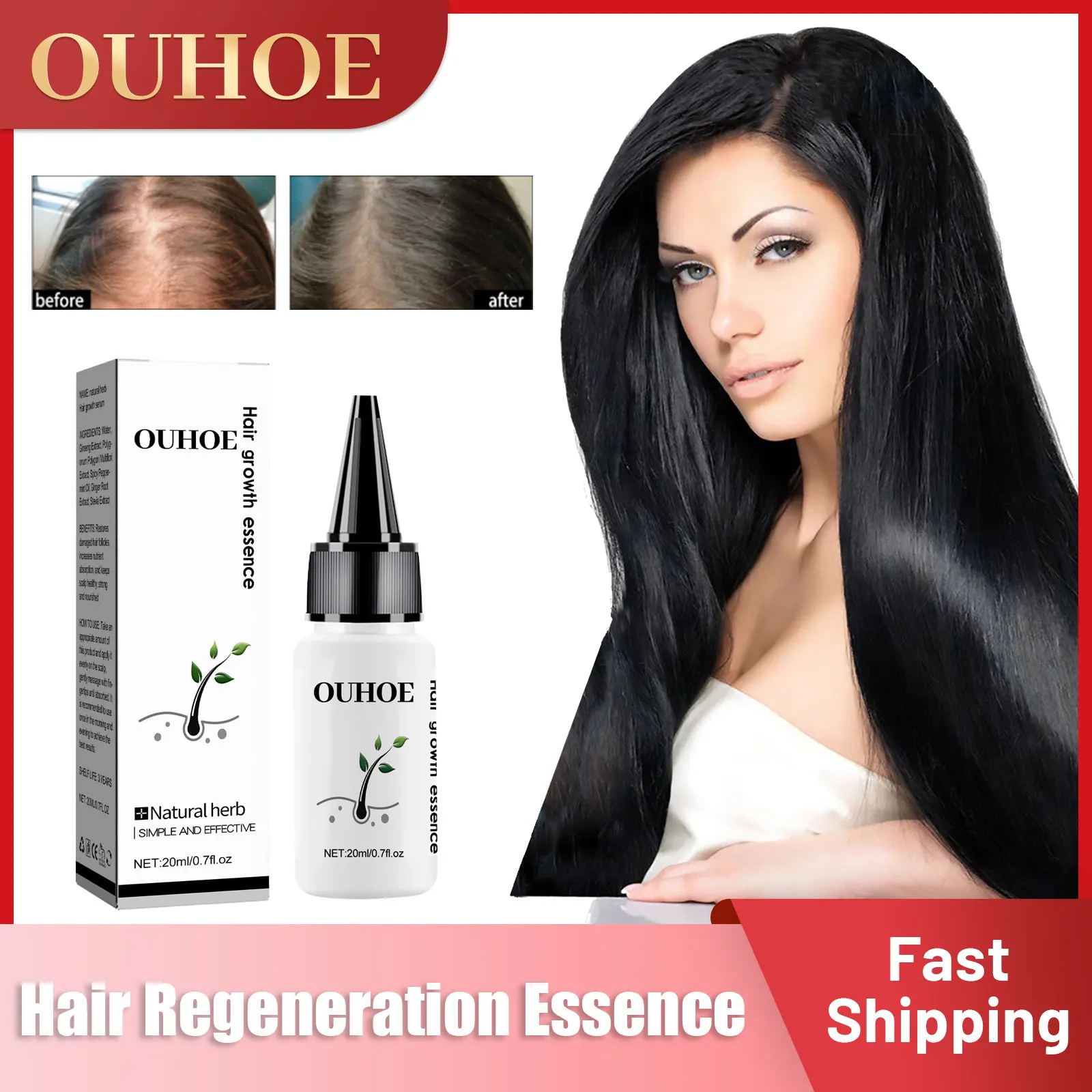 

Hair Growth Serum Anti Hair Loss Nourishing Scalp Repair Damage Follicle Seborrheic Alopecia Treatment Improving Balding Essence