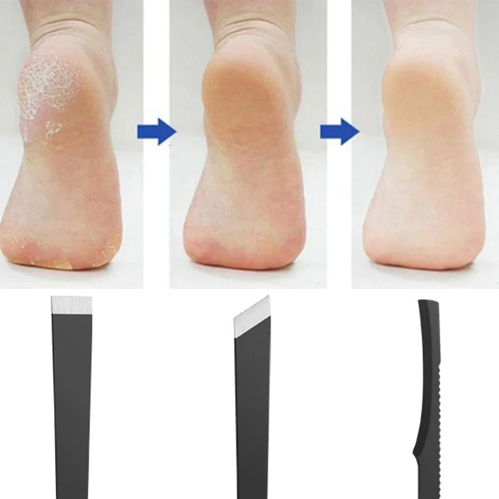 Sdotter 3 шт. набор ножей для педикюра скребок ногтей маникюрные инструменты ног