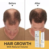 hair growth spray anti hair loss essential oil for men women repair damaged hair roots product for hair regrowth and balding