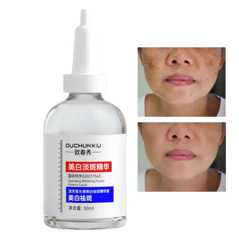 

Black Spot Remover Anti-Dark Spots Fade Essence 50ml Brightening Essence Freckles Removing Age Spot Remover For Purifying Pores