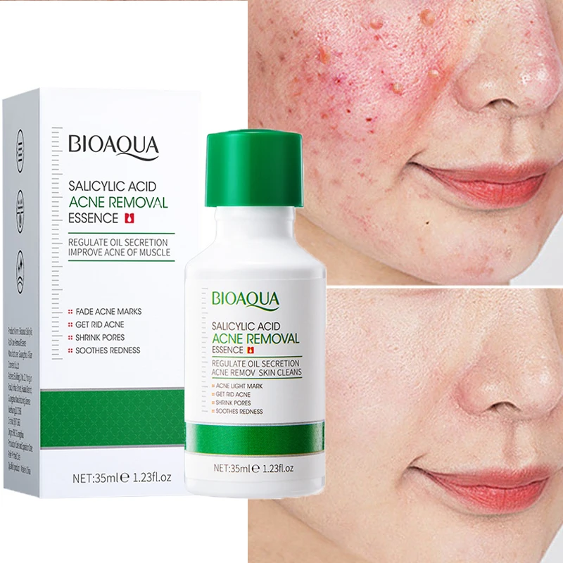 Salicylic Acid Acne Removal Essence Control Oil Moisturizing Shrink Pores Skin Care Remove Dark Spots Acne Smooth Brighten Serum