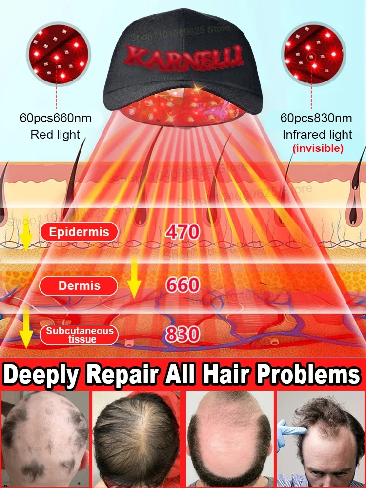 Экспозиция à la lumière rouge and blue plus de calvitie