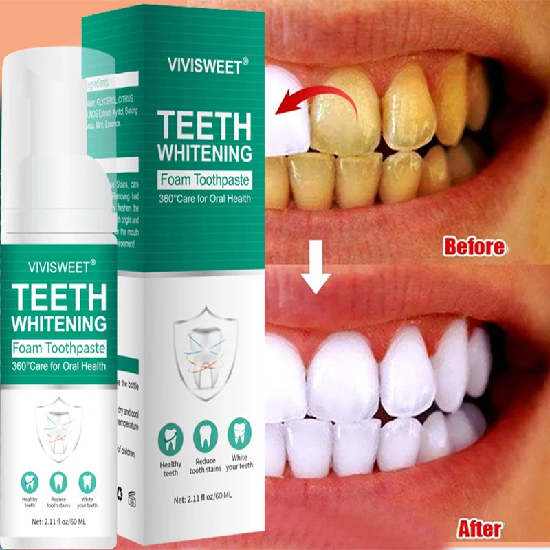 

V34 Teeth Whitening Remove Smoke StainsPlaque Tooth Stain Gingival Repair Caries Oral Hygiene Tooth Whitening Product Toothpaste