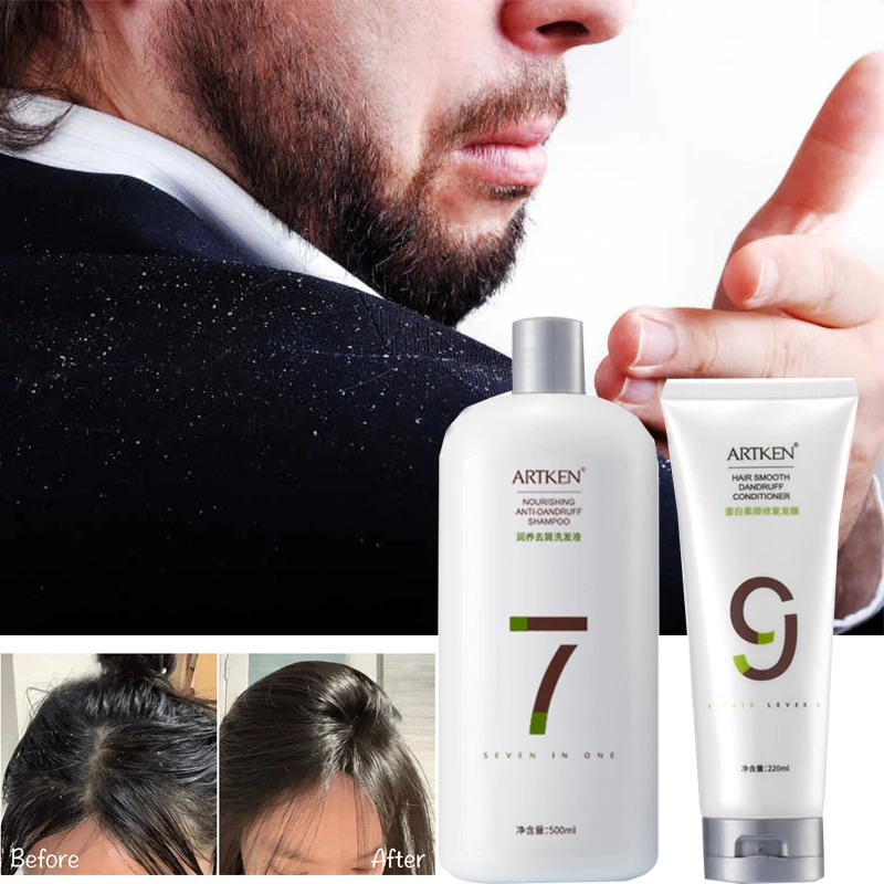 Anti-dandruff anti-itch shampoo set refreshing shampoo degreasing  softening conditioner hair mask Hair care Free shipping