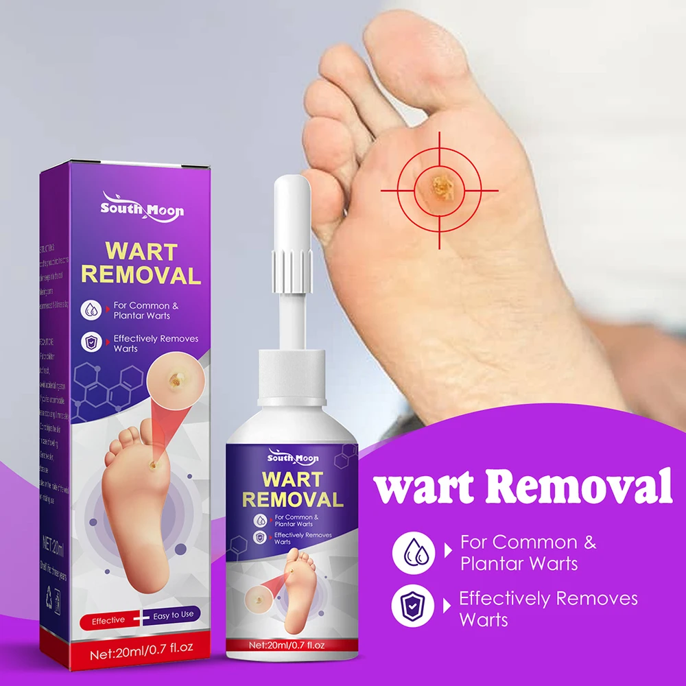 

Foot Corn Removal Liquid Painless Genital Warts Treatment Papillomas Calluses Skin Tag Remover Bacteriostatic Foot Repair Tools