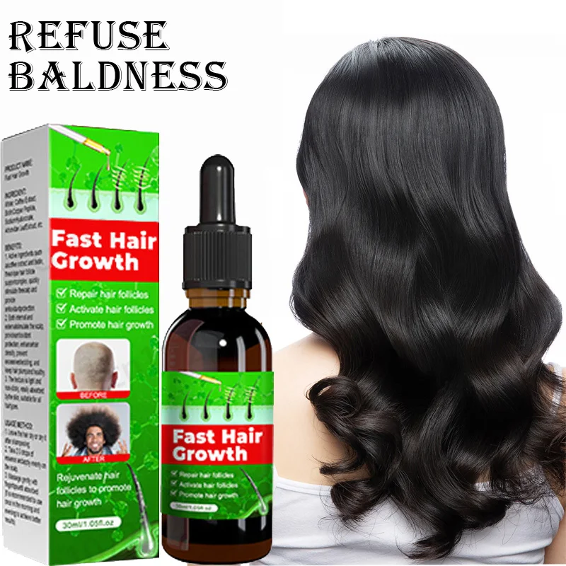 

Быстрое средство для роста волос, средство против выпадения волос, травяное эфирное масло для лечения алопеции, эссенция для роста волос, естественная безопасность