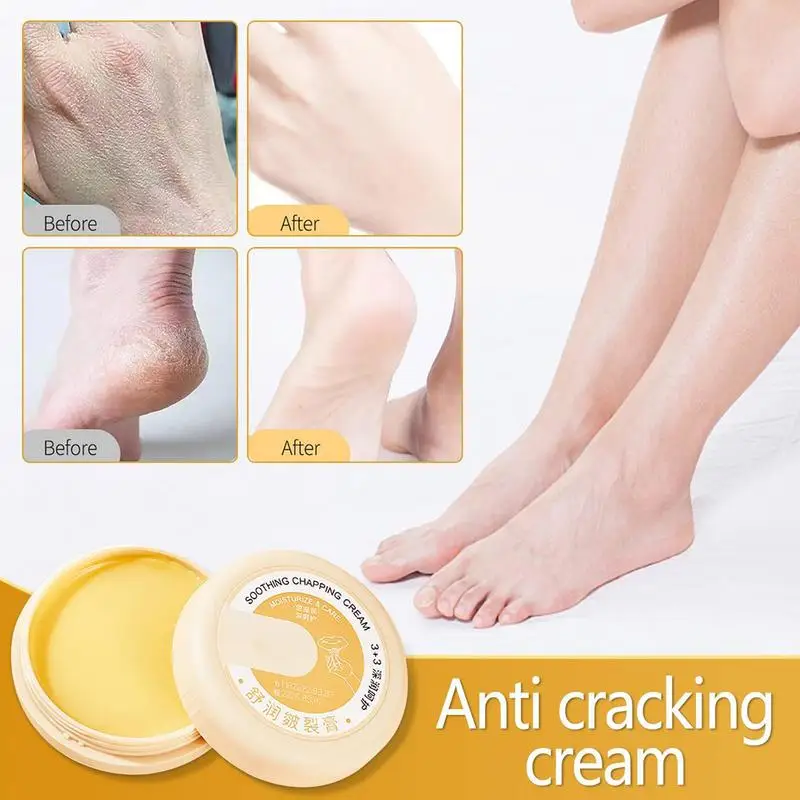 

20g Anti Cracking Foot Hand Cream Skin Repair Cream Nourishing Crack Heel Healing Ointment Elbows Knees Hydrating Moisturizer