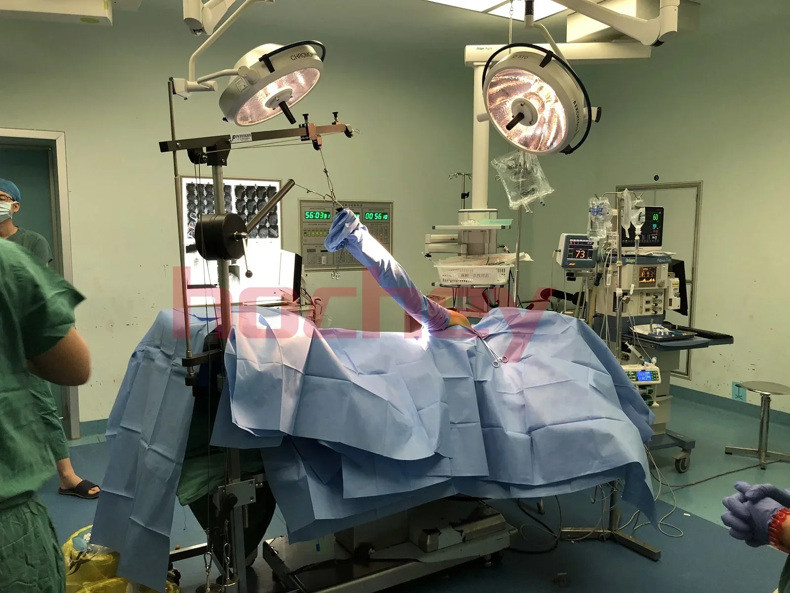 Детали для операционного стола поддержка артроскопии плеч операционная рама