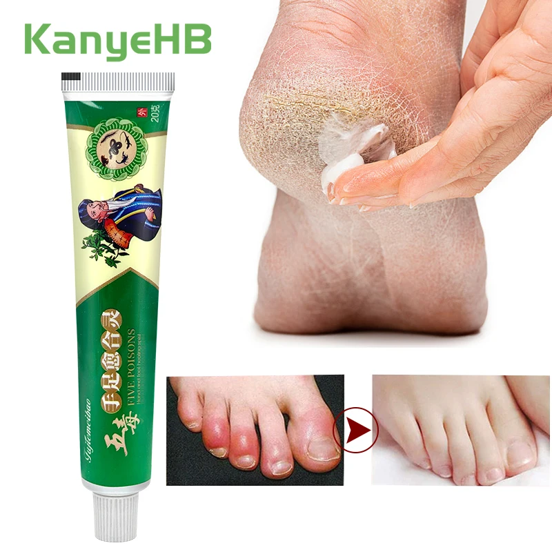 

1pcs Medical Anti Crack Foot Cream Fast Relief Hand Foot Drynes Heel Cracked Removal Dead Skin Repair Moisturizing Ointment S103
