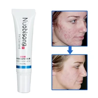 nuobisong anti spot cream face gel acne marks removal cream blackhead removal striae gravidarum pigmentation corrector cream 15g