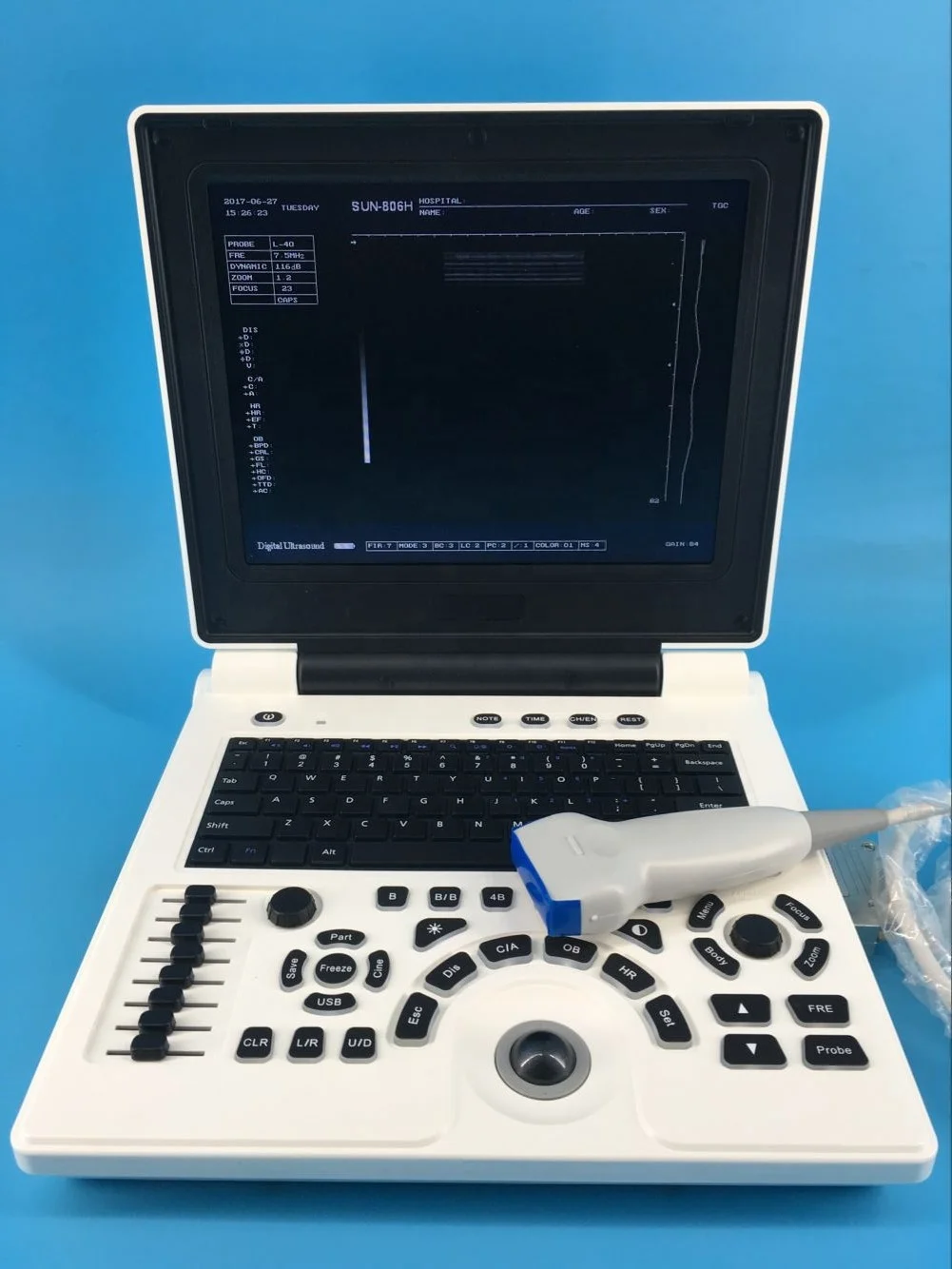 

Small Ultrasound Scanner for Doctor SUN-806H + Convex Probe + Straight Probe
