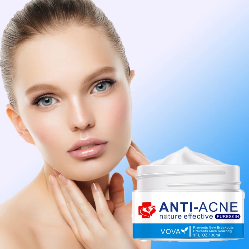 

Effective Acne Removal Cream Herbal Treatment Acne Spots Oil Control Lighten Acne Marks Scars Shrink Pores Moisturizer Skin Care