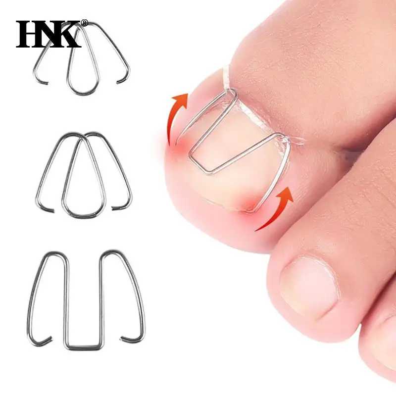 

3Pairs Front Nail Hook Nail Art Ingrown Toe Nail Correction Toenail Nail Ingrown Clip Orthosis Paronychia Pedicure