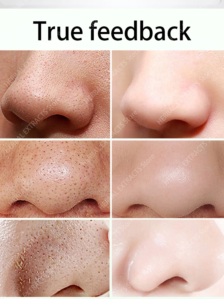 Маска с зеленым чаем от черных точек уход за кожей очистка лица сужение пор