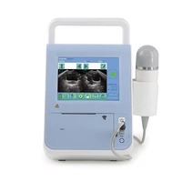 mabs04 wholesale medical supplies cheap hand held bladder scanner portable ultrasound with 3d probe