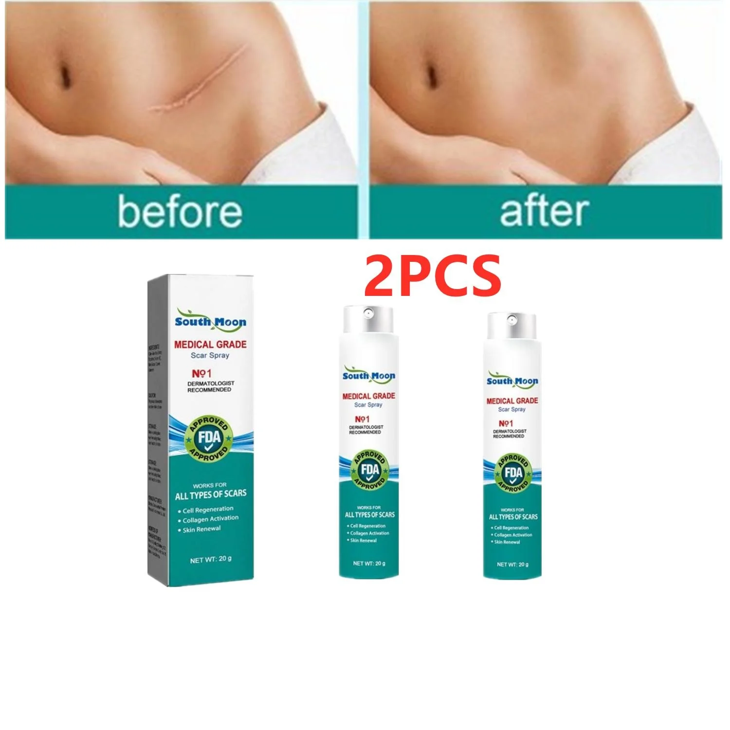 

2pc Scar Removal Spray Remove Caesarean Section Scars Stretch Mark Keloid Scars Surgical Scars Burn Scald Severe Scars Treatment