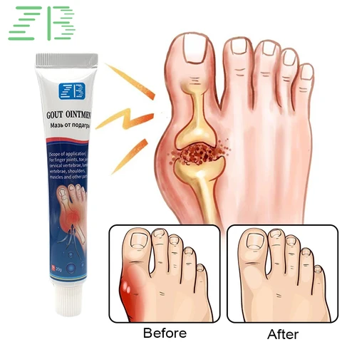 WINSLET Крем для лечения подагры 20г