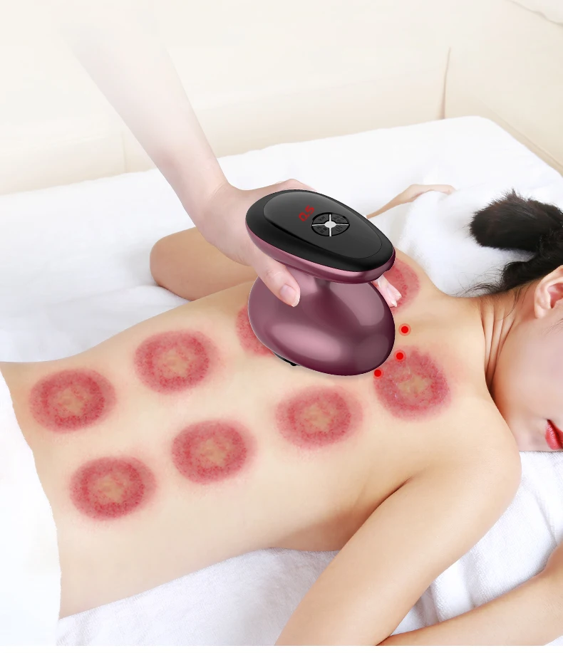

Wholesale Top Quality Scraping massager Electric Scraping Massage for body scraping instrument