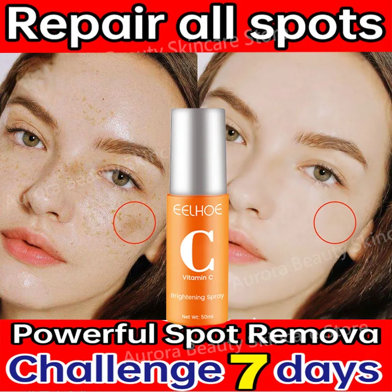 

Vitamin C Whitening Freckles Face Serum Remove Dark Spots Fade Melasma Anti-Aging Brighten Moisturizing Essence Toner Skin Care