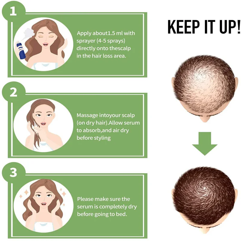 Масло эфирное Ginger Hair Growth Essential Oil для быстрого роста волос и профилактики облысения у мужчин и женщин.