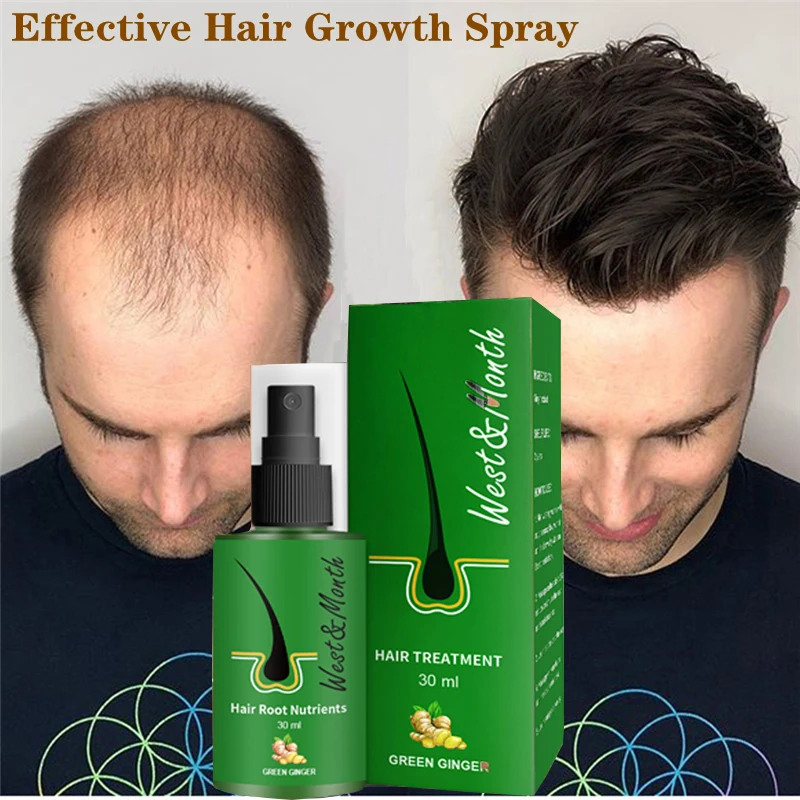 

30ml Hair Growth Essence Prevent Hair Loss Repair Serum Fast Growth Oil Herbs Treatment for Men and Women Thick Hair Care New
