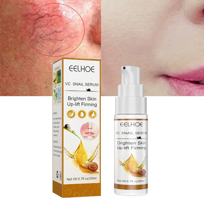 

Repair Facial Redness Essence Soothing Soluation Sensitive Skin Treatment Shrink Pores Anti Aging Wrinkle Whiten Brighten Care