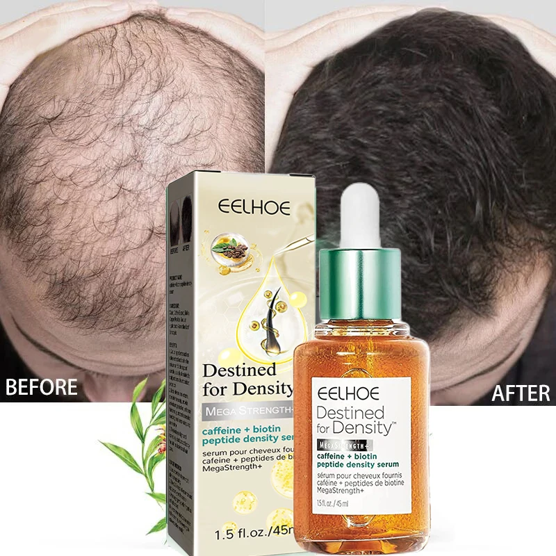 eelhoe Fast Hair Growth Products Serum For Women Men Baldness Hair Loss Treatment Beard Hair Growth Oils Beauty Health Care 45ml
