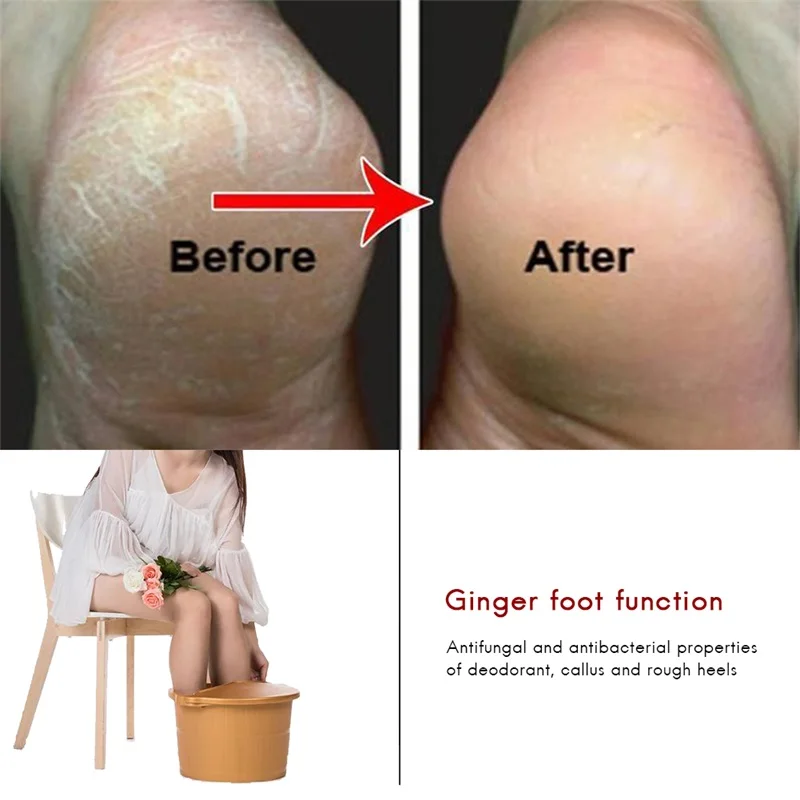 

Sdotter 10cs/bag Of Ginger Foot Effervescent Tablets Promote Metabolism Prevention Eliminate Fatigue Swelling Pain Foot Care Tre