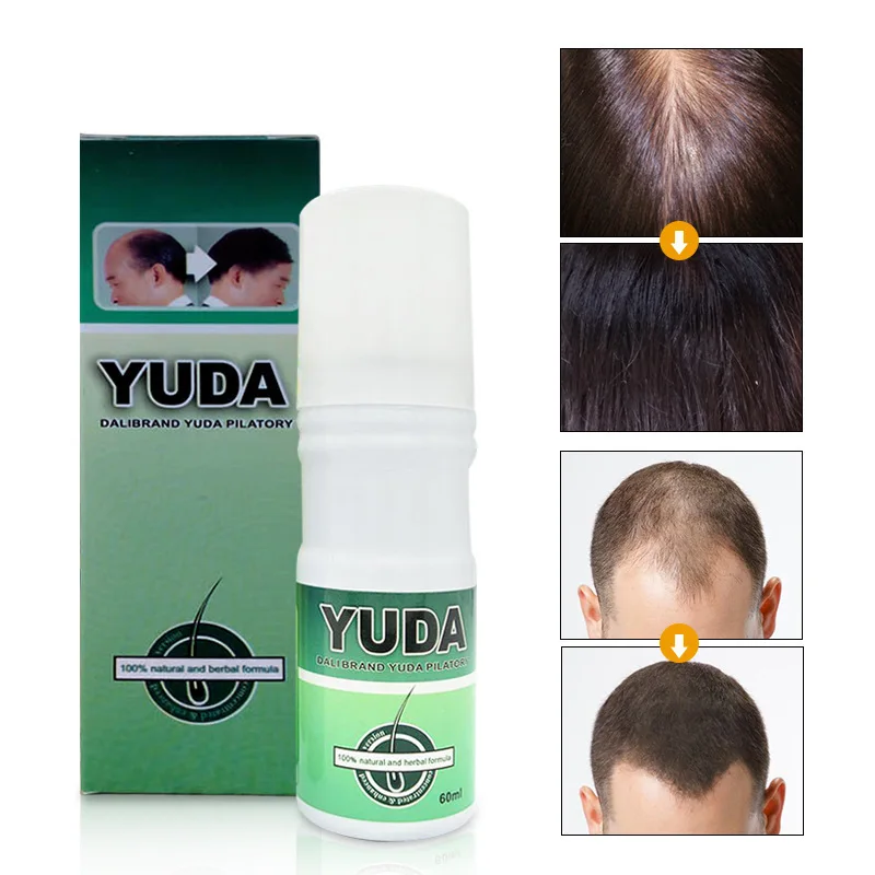 YUDA Hair Growth Spray Serum Anti Hair Loss Products Fast Grow Prevent Hair Dry Frizzy Damaged Thinning Repair Care
