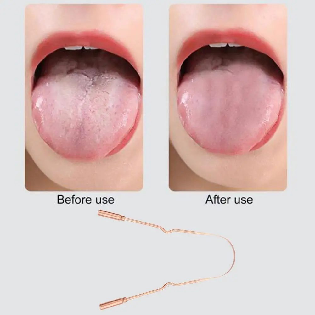 

1 шт., скребок для языка G3t6