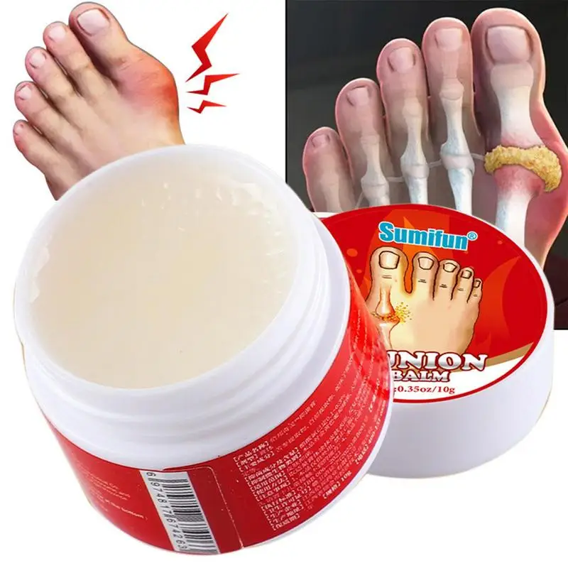 

Мазь для большого пальца ноги, деформации вальгусной деформации, 10 г, облегчение боли в большом пальце, медицинский пластырь, уход за ногами