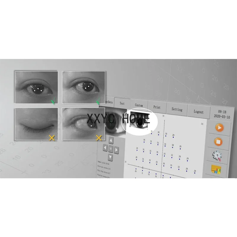 Автоматический визуальный фотофтальмологический проекционный периметр