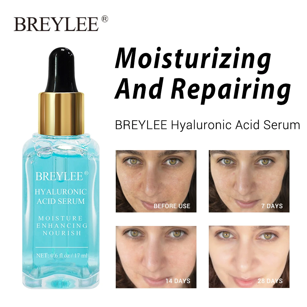 

BREYLEE Vitamin C Essence Lightens Dark Spots Freckles Brightening Facial Whitening Deep Hydrating Essence Refreshing Facial Tre