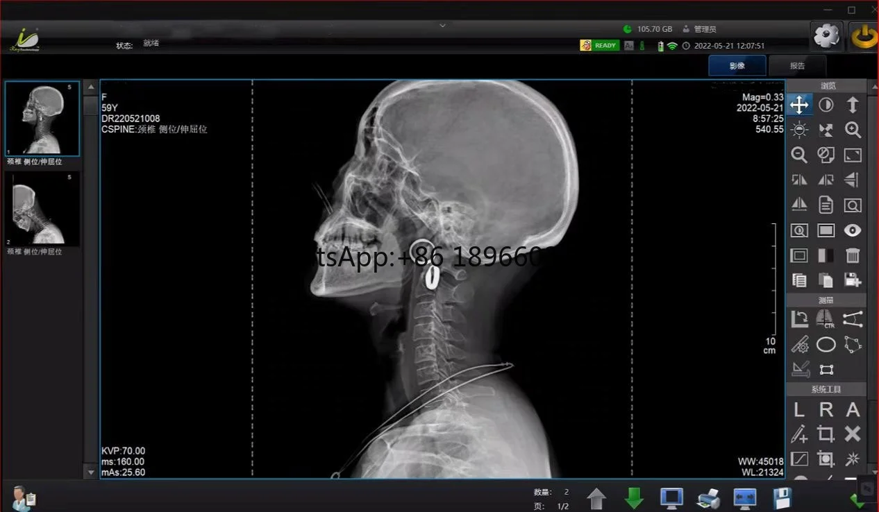 Специальное предложение 17*17 дюймов медицинская цифровая dr панель проводной 1717