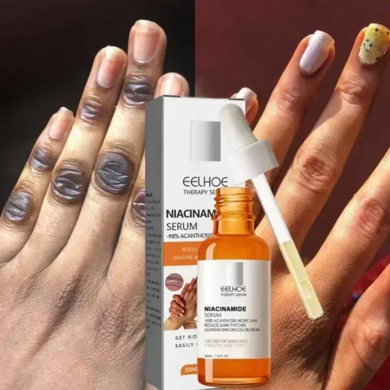 Омолаживающая сыворотка для локтей темных коленей удаление кожи частными