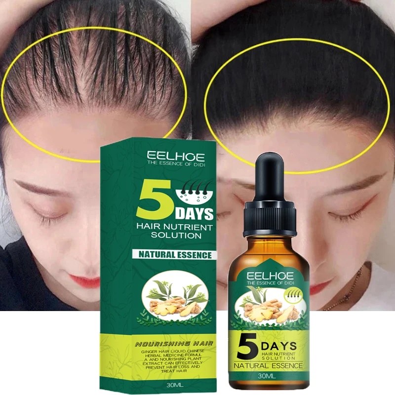 5 Day Ginger Hair Care Essence Fast Hair Growth Products For Men Women Serum Dense Natural Nutrient Oil Accelerator For Stronger