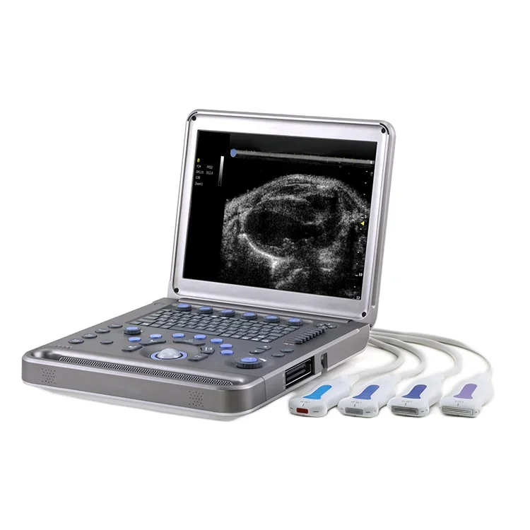 Цветной Допплер, эхомашина, допплеровский