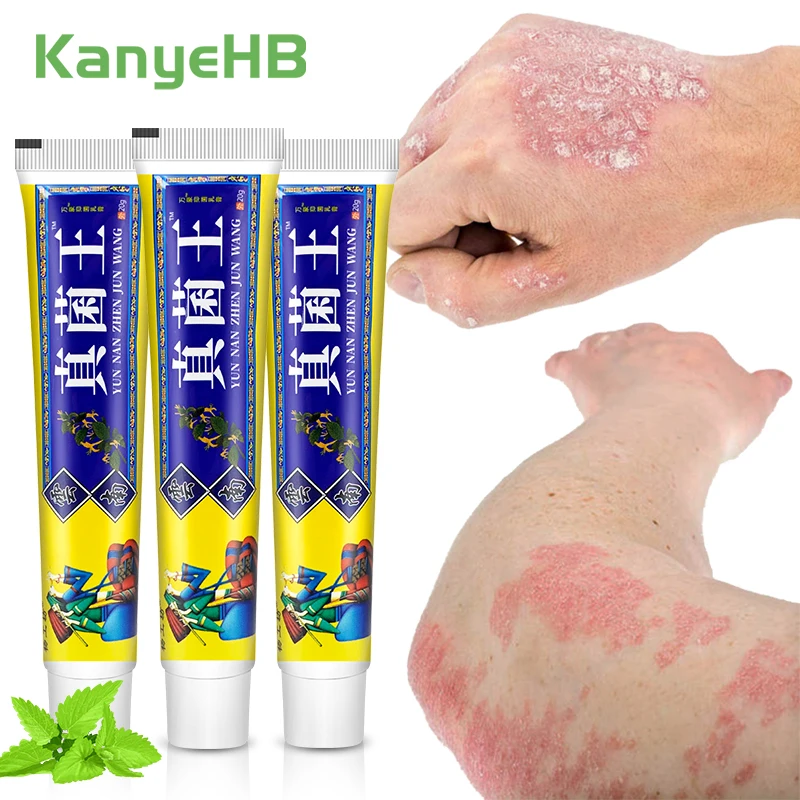 

1-3-5pcs Psoriasis Dermatitis Eczema Cream Relieve Itch Treat Skin Fungal Infection Beriberi Medical Plaster Mint Cooling Cream