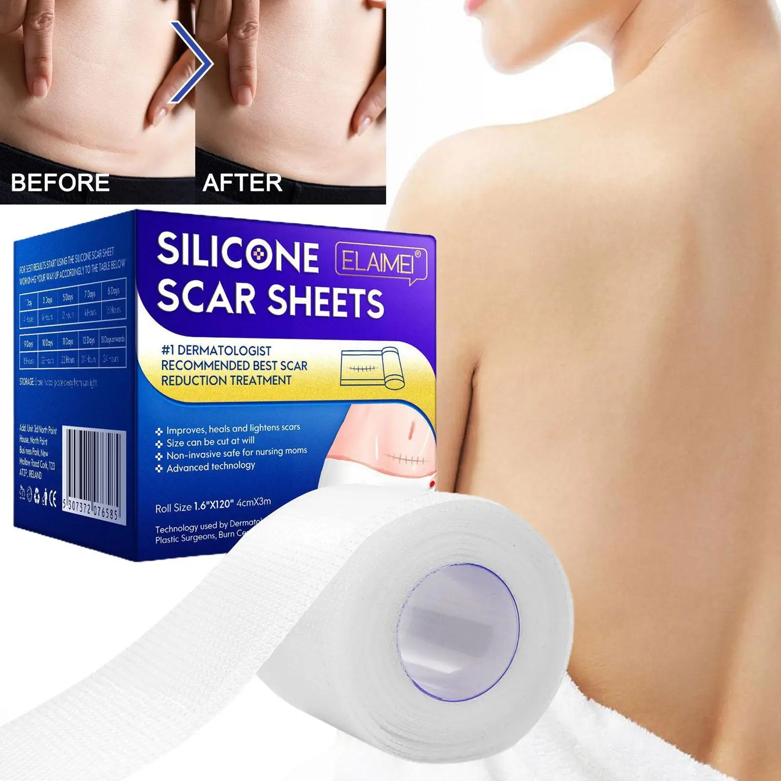 

4cm*1.5m Efficient Surgery Scar Removal Silicone Gel Tape Sticker Therapy Patch For Acne Trauma Burn Scar Repair Patch Skin J0T5