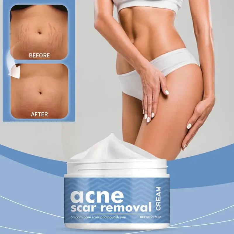 Крем для лица удаления прыщей гель против лечение шрамов от сужение пор