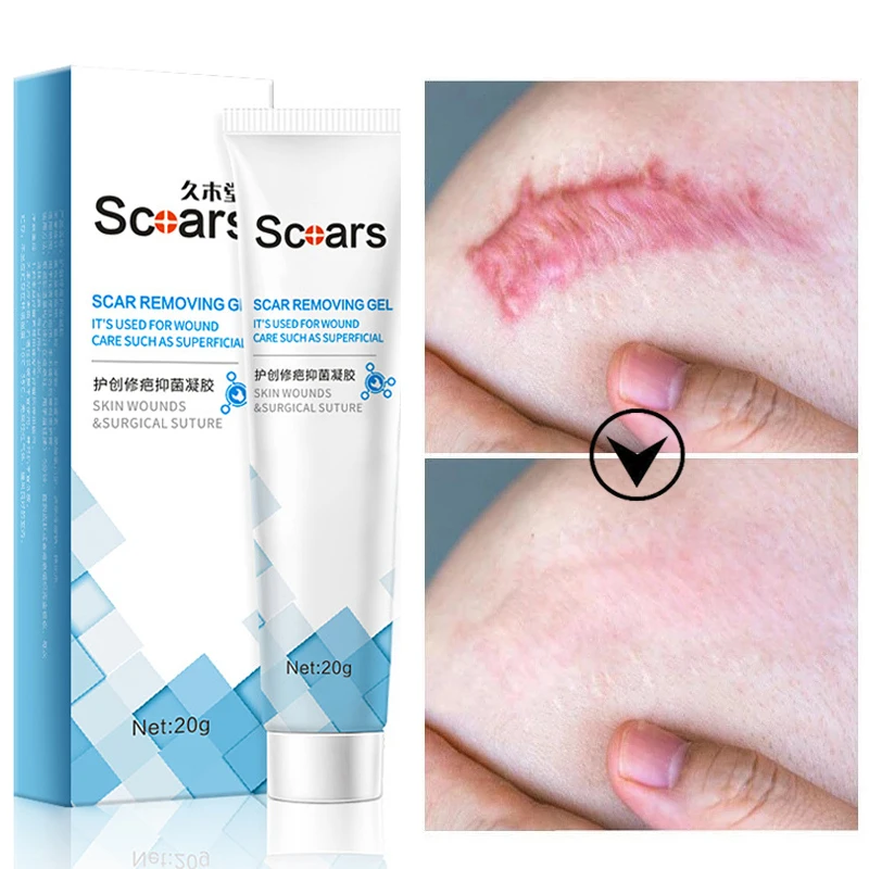 

Herbal Scar Removal Cream Gel Repairing Pock Mark Burn Surgical Scar Cesarean Scar Stretch Marks Smooth Moisturizing Skin Care