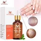 Средство для лечения грибков ногтей, эссенция для ухода за ногами, отбеливание ногтей на ногах, удаление грибка на ногтях, антиинфекционный гель для лечения паронихии и онихомикоза