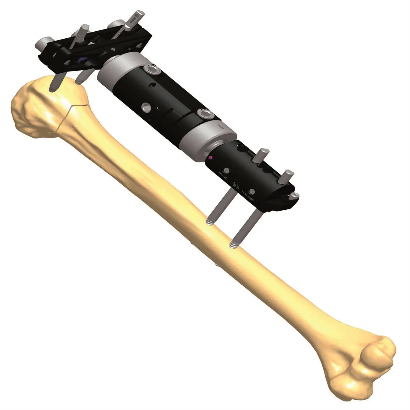

Micro movement external fixator with T clamp(210-230mm)