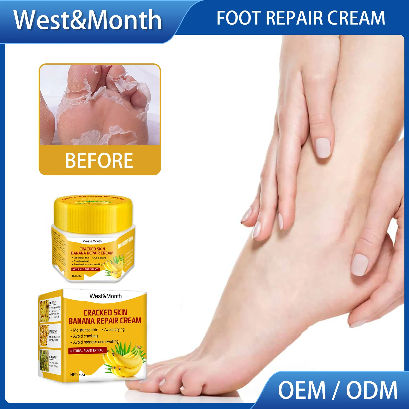 

Crack Heel Cream Anti-Freezing Crack Anti-Chapping Nourishing Moisturizing Hand Heel Crack Cream Crack Foot Cream Heel Cream