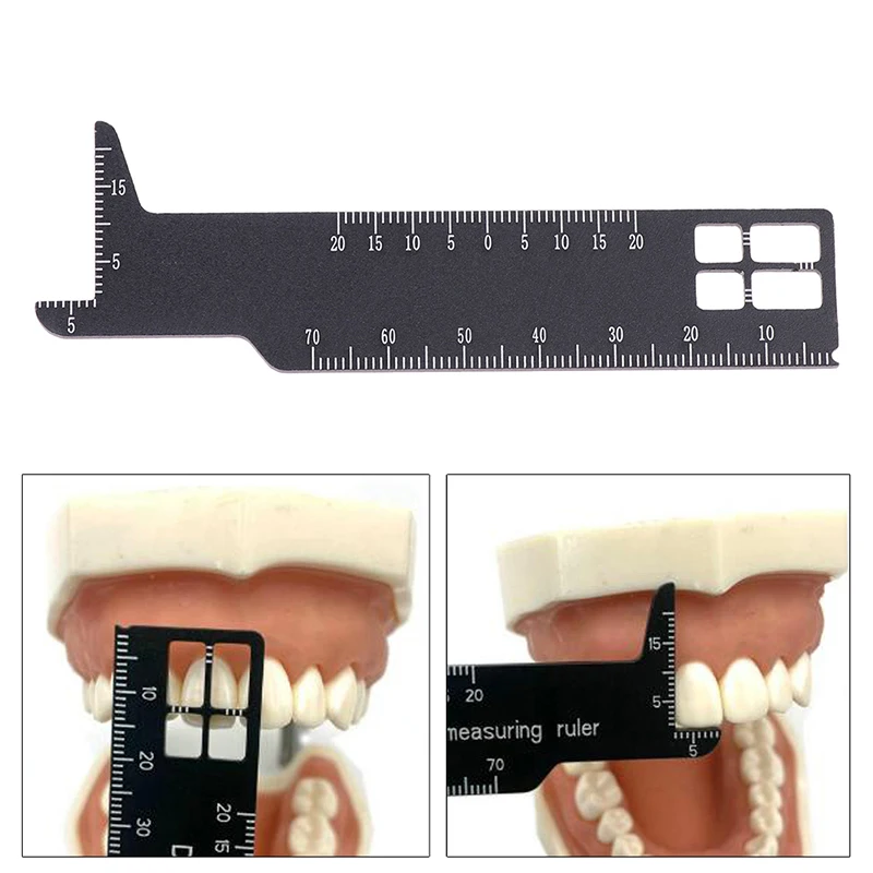 

Новая Стоматологическая Точная измерительная линейка, медицинский инструмент для фотографии и стоматологии