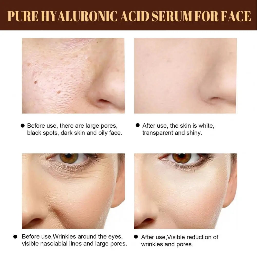 

Практичный лосьон для лица, 30 мл, мягкая эссенция для лица, жидкая натуральная сужающая поры, жидкая эссенция для восстановления лица