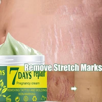 remove stretch marks cream effective remove obesity pregnancy body marks postpartum scar acne firming body skin repair creams