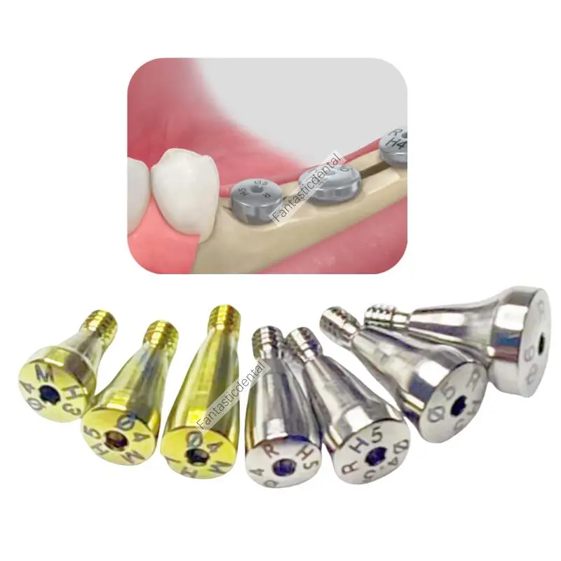 5 шт. стоматологические лечебные аксессуары для лечебного стержня Osstem колпачки