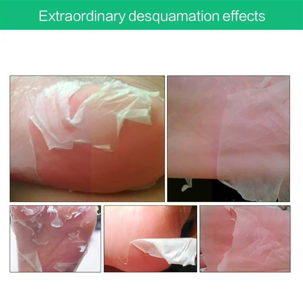 

1pair Aloe Vera Foot Exfoliating Foot Peel Skin Feet Vera Anti Heel Removes Peeling Aloe Dead Cracked Callus A4o7