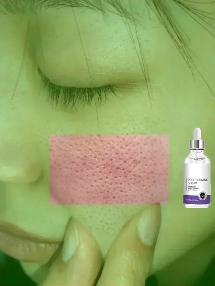 Текстура кожи | Осветляющая сыворотка для лица очищения пор с ретинолом и